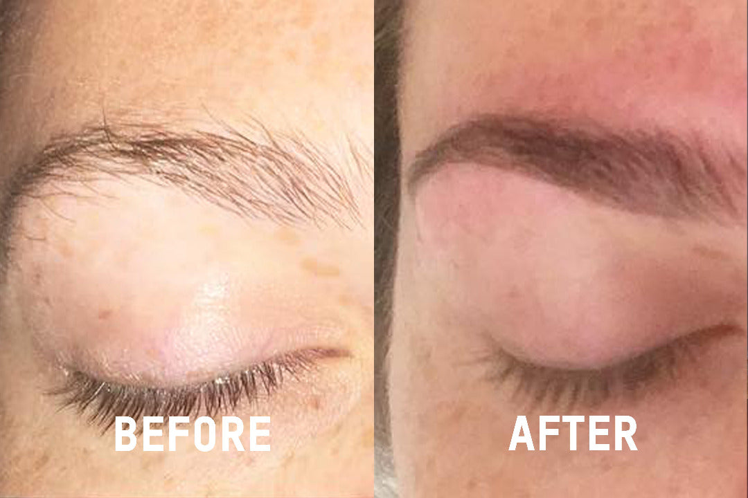 Nourishbrow eyebrow growth serum before and after